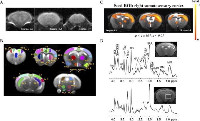 Altered Forebrain Functional Connectivity and Neurotransmission in a Kinase-Inactive Met Mouse Model of Autism.