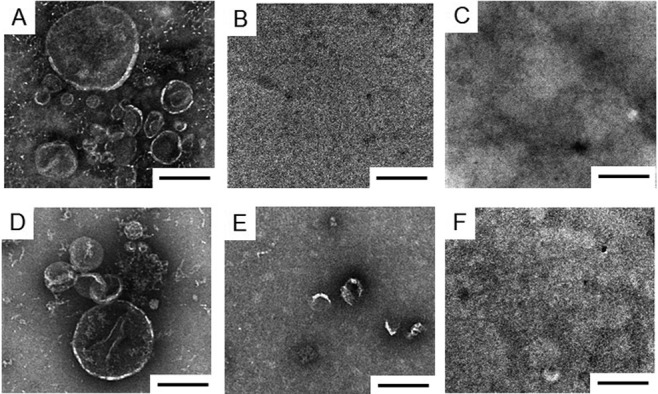 IgA-enhancing effects of membrane vesicles derived from <i>Lactobacillus sakei</i> subsp. <i>sakei</i> NBRC15893.