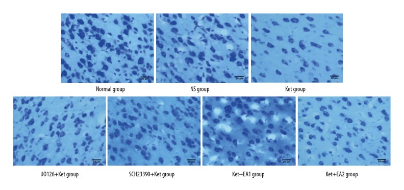 Effects of Electroacupuncture on Expression of D1 Receptor (D1R), Phosphorylation of Extracellular-Regulated Protein Kinase 1/2 (p-ERK1/2), and c-Fos in the Insular Cortex of Ketamine-Addicted Rats.