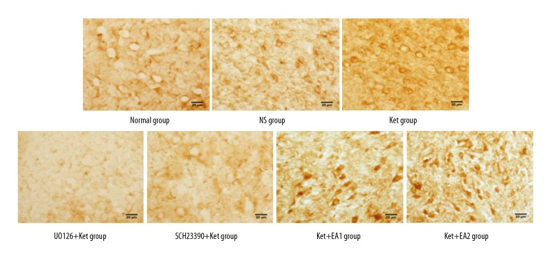 Effects of Electroacupuncture on Expression of D1 Receptor (D1R), Phosphorylation of Extracellular-Regulated Protein Kinase 1/2 (p-ERK1/2), and c-Fos in the Insular Cortex of Ketamine-Addicted Rats.