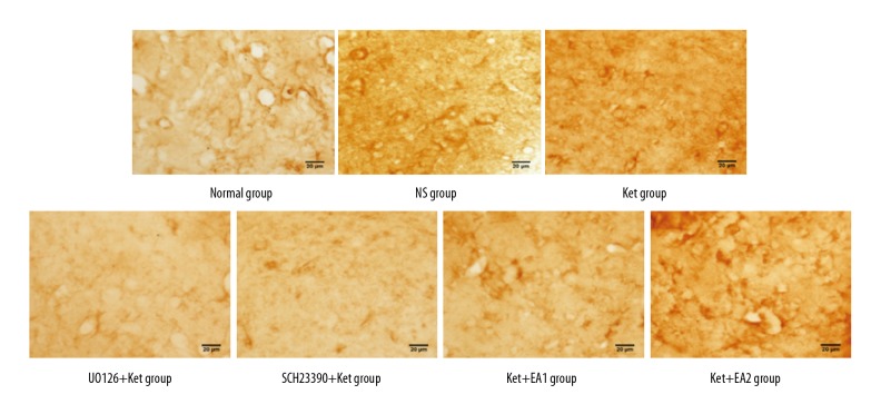 Effects of Electroacupuncture on Expression of D1 Receptor (D1R), Phosphorylation of Extracellular-Regulated Protein Kinase 1/2 (p-ERK1/2), and c-Fos in the Insular Cortex of Ketamine-Addicted Rats.