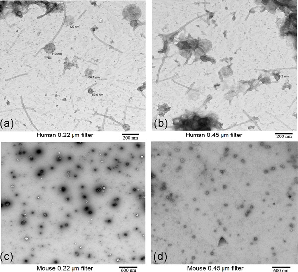 A Method for Isolation and Proteomic Analysis of Outer Membrane Vesicles from Fecal Samples by LC-MS/MS.