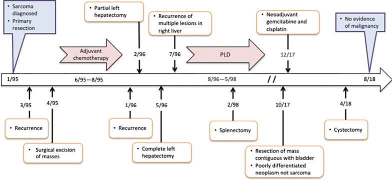 Long-term cure of soft tissue sarcoma with pegylated-liposomal doxorubicin after doxorubicin and ifosfamide failure.