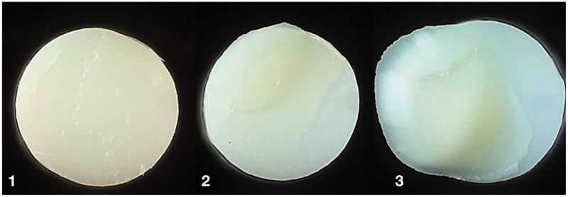 Debonding mechanism of zirconia and lithium disilicate resin cemented to dentin.