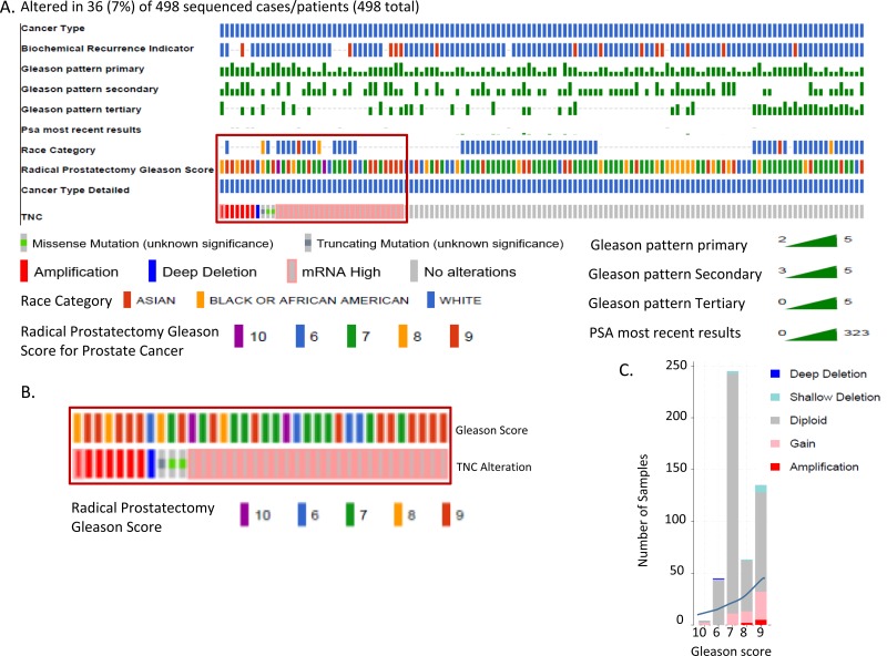 Genomic alterations of Tenascin C in highly aggressive prostate cancer: a meta-analysis.