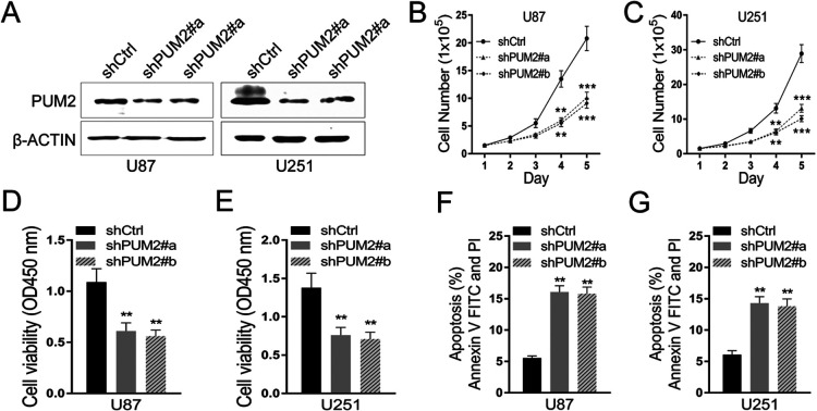 PUM2 Promotes Glioblastoma Cell Proliferation and Migration via Repressing BTG1 Expression.