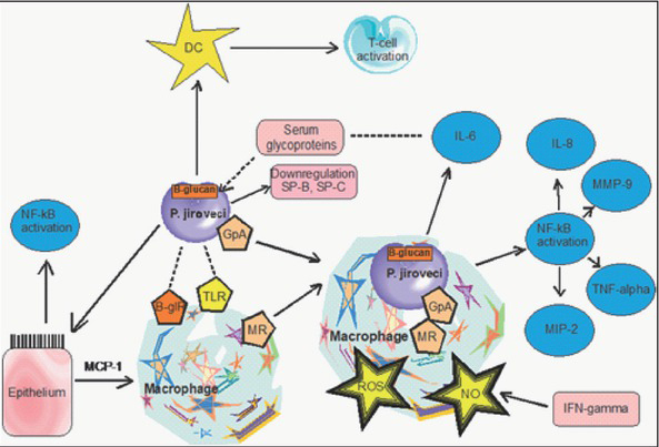 Pneumocystis pneumonia: still a serious disease in children.