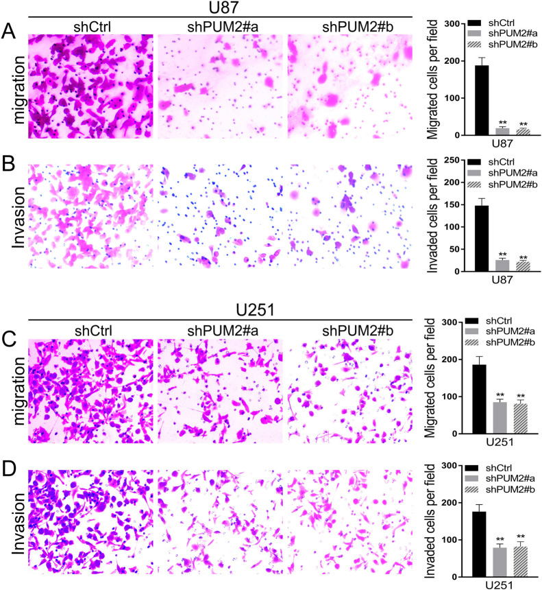 PUM2 Promotes Glioblastoma Cell Proliferation and Migration via Repressing BTG1 Expression.