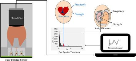 Non-invasive characterization of chick embryo body and cardiac movements using near infrared light