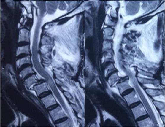 Animal Injuries; a Case Series of Bull Induced Injuries in India.