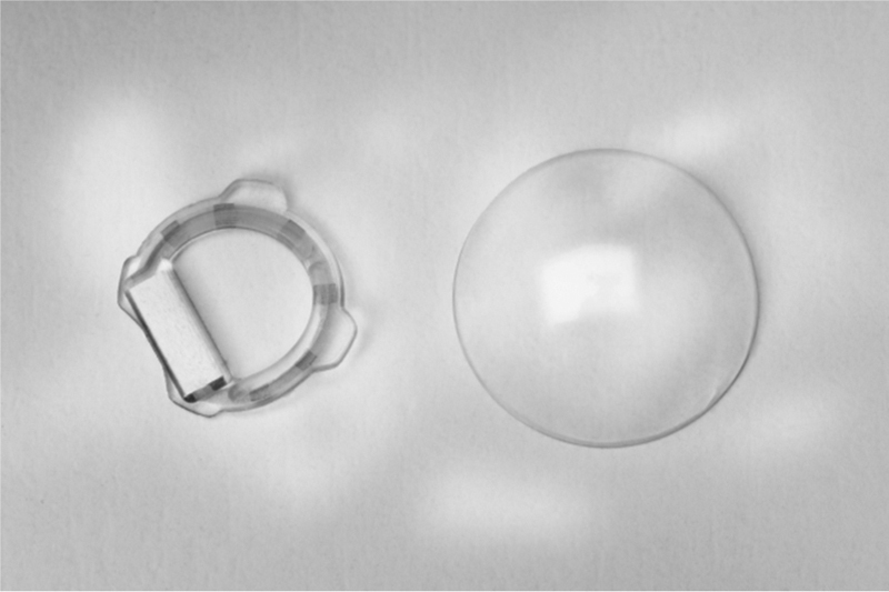 Advances in diagnostic applications for monitoring intraocular pressure in Glaucoma: A review.