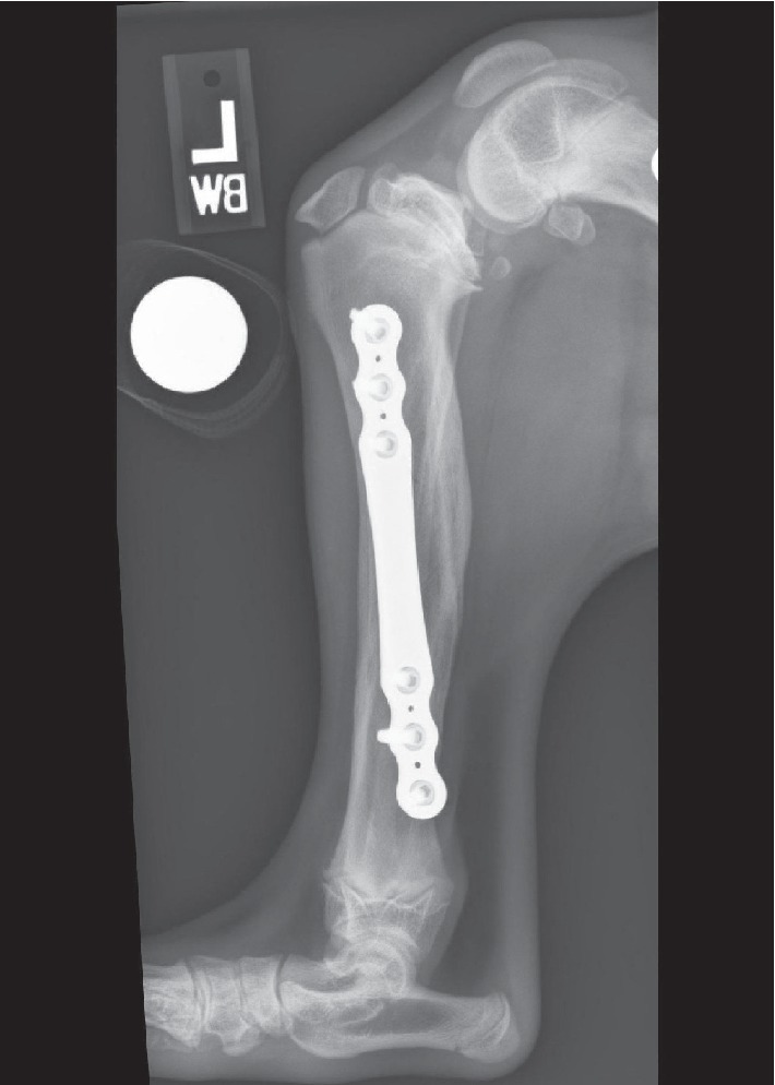 Correction of Excessive Tibial Plateau Angle and Limb Shortening in a Juvenile Dog Using a Hinged Circular Fixator Construct and Distraction Osteogenesis.