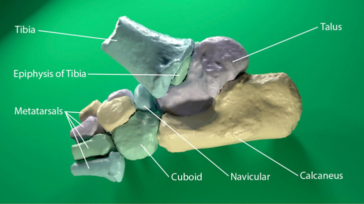 Visualization of a Juvenile Australopithecus afarensis Specimen: Implications for Functional Foot Anatomy.