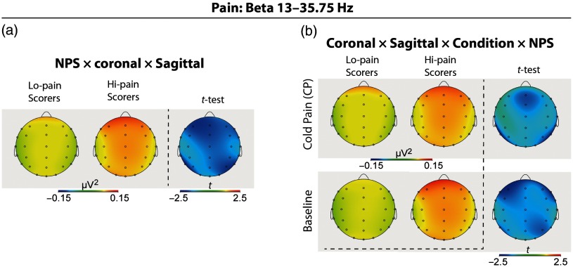 Changes of EEG band oscillations to tonic cold pain and the behavioral inhibition and fight-flight-freeze systems.