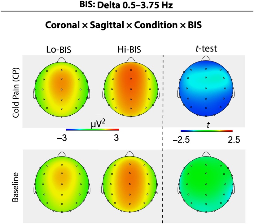 Changes of EEG band oscillations to tonic cold pain and the behavioral inhibition and fight-flight-freeze systems.