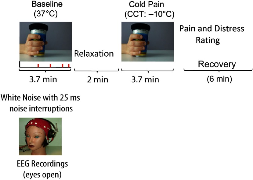 Changes of EEG band oscillations to tonic cold pain and the behavioral inhibition and fight-flight-freeze systems.