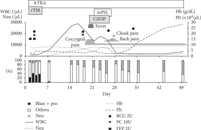 Prolonged Myelosuppression due to Progressive Bone Marrow Fibrosis in a Patient with Acute Promyelocytic Leukemia.