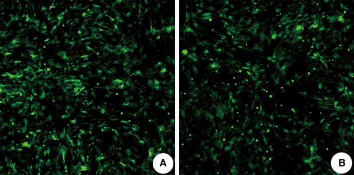 miR-455-5p Overexpression Reduces Rat Lung Alveolar Type II Cell Proliferation by Downregulating STRA6.