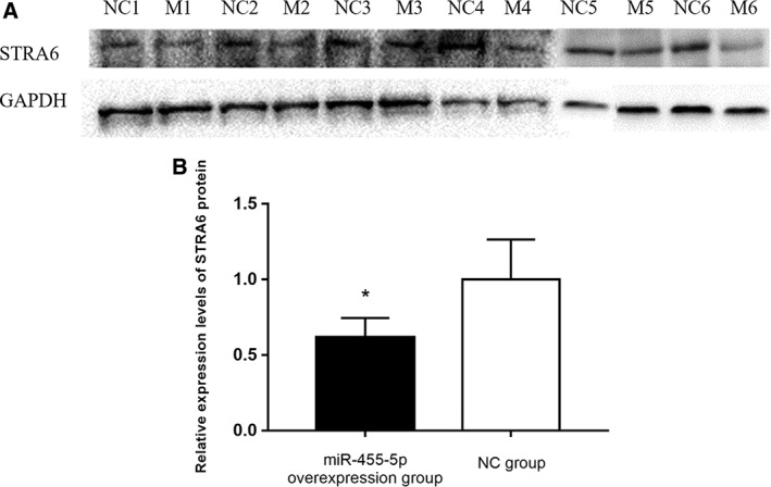 miR-455-5p Overexpression Reduces Rat Lung Alveolar Type II Cell Proliferation by Downregulating STRA6.