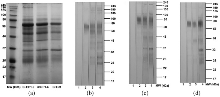 Cross-reactivity with Brazilian strains of <i>Neisseria meningitidis</i> B after immunization with outer membrane vesicles.