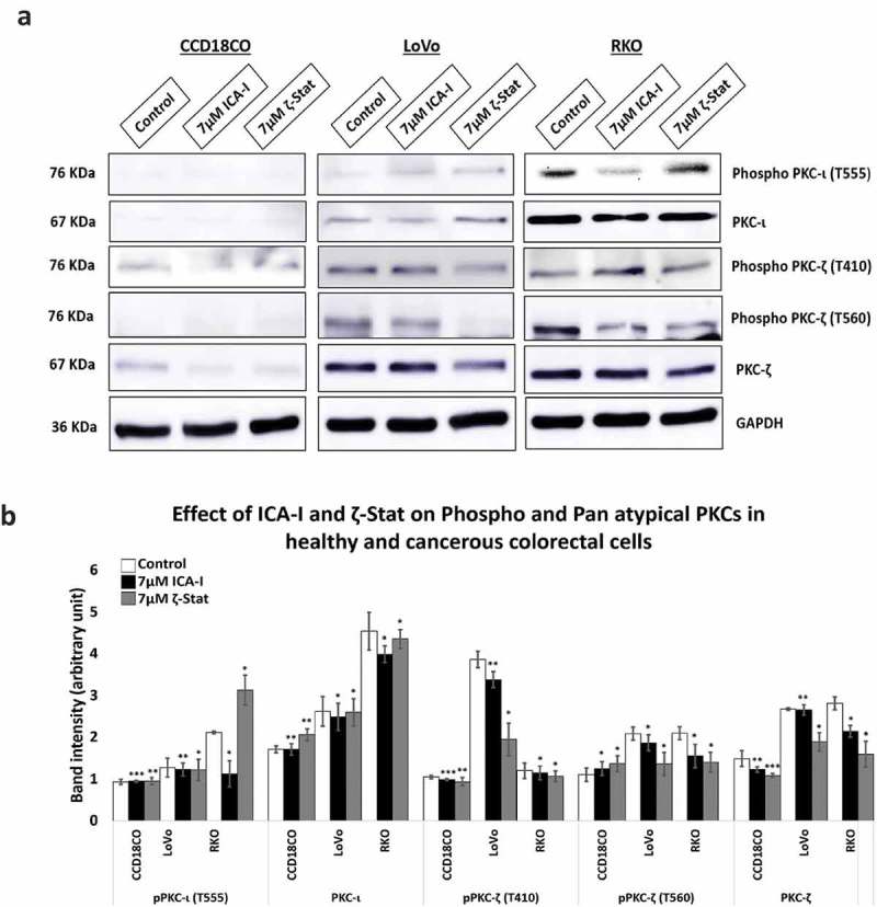 The modulation of actin dynamics via atypical Protein Kinase-C activated Cofilin regulates metastasis of colorectal cancer cells.