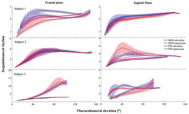 The effect of intracortical bone pin on shoulder kinematics during dynamic activities.
