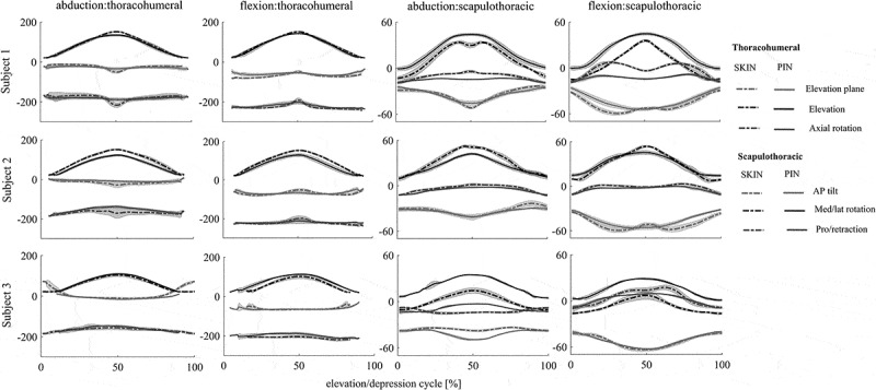 The effect of intracortical bone pin on shoulder kinematics during dynamic activities.
