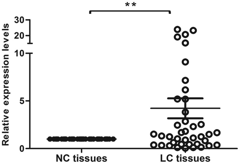 Snail2 induced E-cadherin suppression and metastasis in lung carcinoma facilitated by G9a and HDACs.