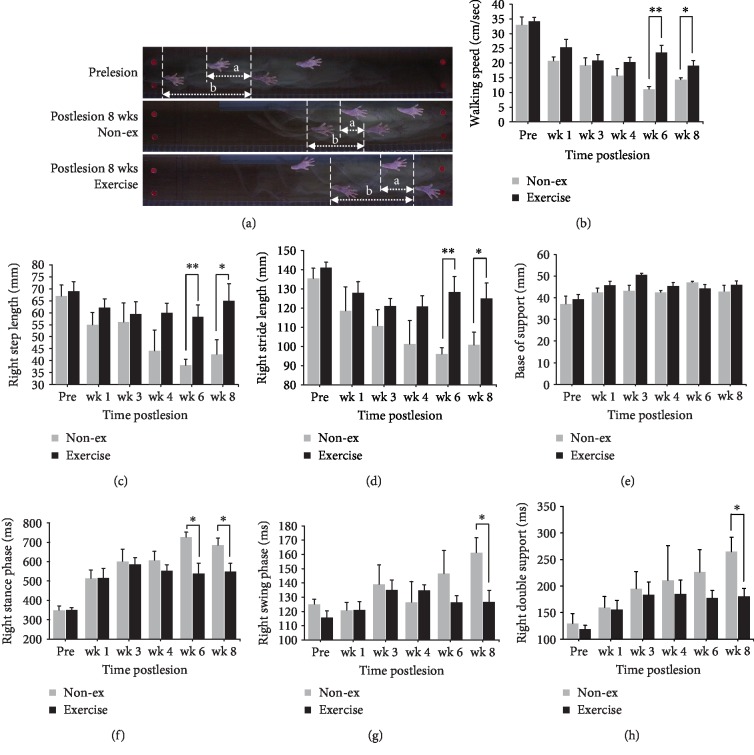 Long-Term Voluntary Physical Exercise Exerts Neuroprotective Effects and Motor Disturbance Alleviation in a Rat Model of Parkinson's Disease.