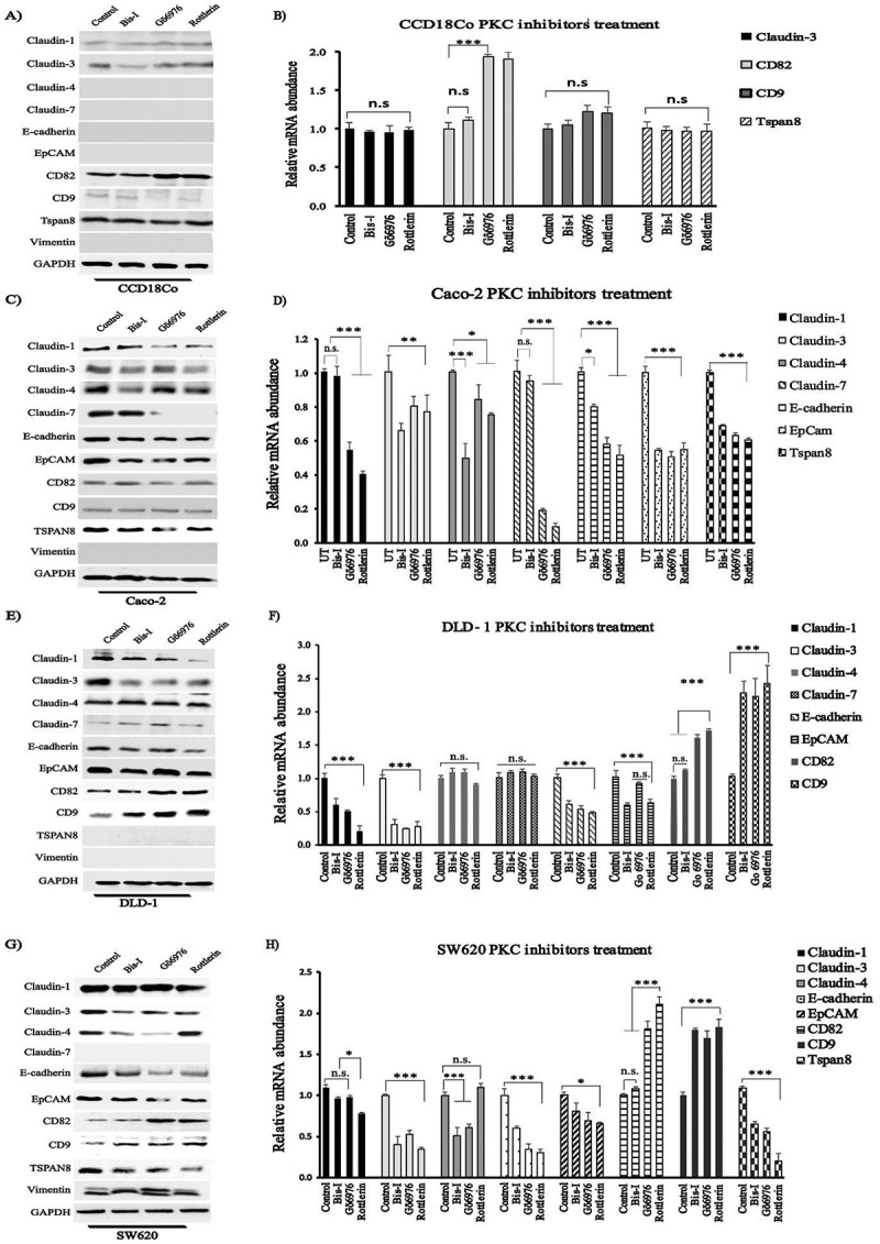 Protein kinase C Inhibitors selectively modulate dynamics of cell adhesion molecules and cell death in human colon cancer cells.