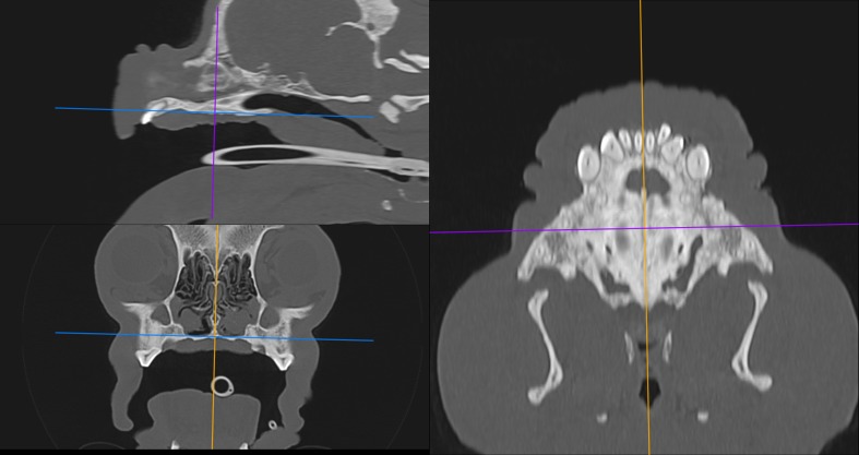 Intraobserver and interobserver reliability of computed tomography measurements of the soft palate in French bulldogs.