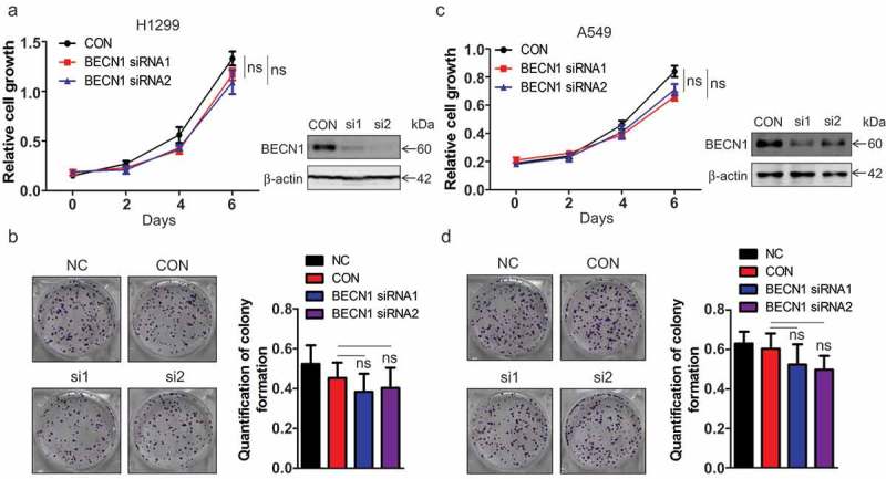 BECN1 promotes the migration of NSCLC cells through regulating the ubiquitination of Vimentin.