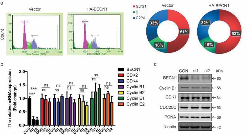 BECN1 promotes the migration of NSCLC cells through regulating the ubiquitination of Vimentin.