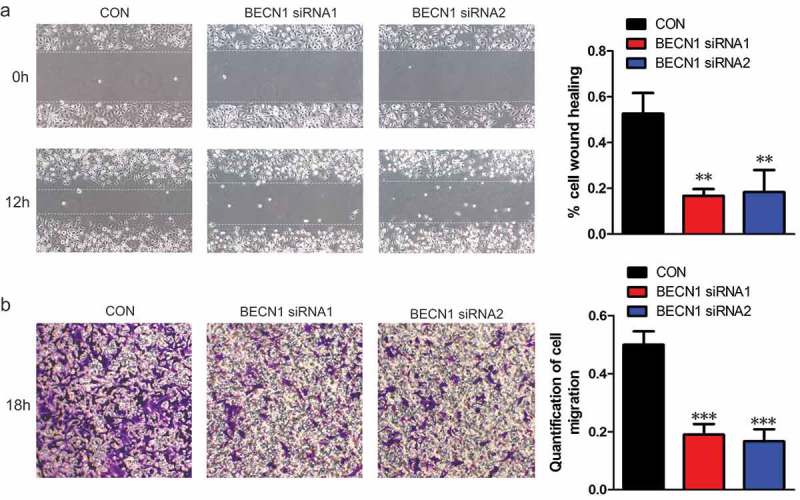 BECN1 promotes the migration of NSCLC cells through regulating the ubiquitination of Vimentin.