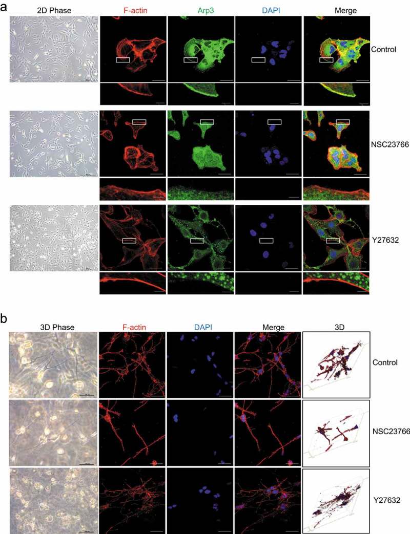 ARHGEF4-mediates the actin cytoskeleton reorganization of hepatic stellate cells in 3-dimensional collagen matrices.