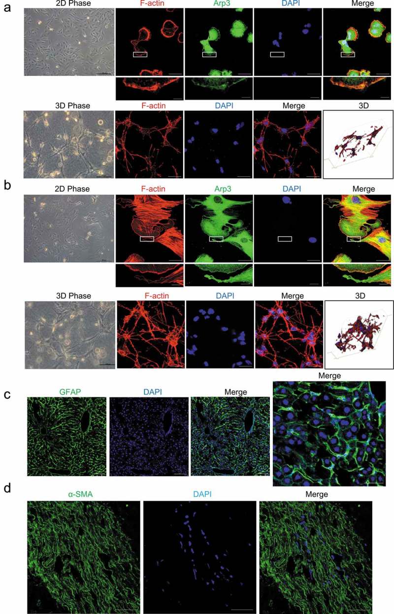 ARHGEF4-mediates the actin cytoskeleton reorganization of hepatic stellate cells in 3-dimensional collagen matrices.