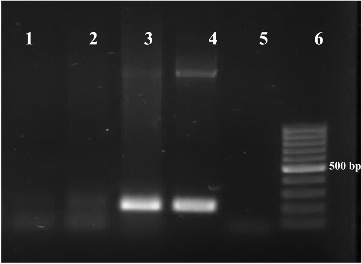 <i>Toxoplasma gondii</i> And <i>Neospora caninum</i> In Brain Tissue Of Rodents In North-West Iran.