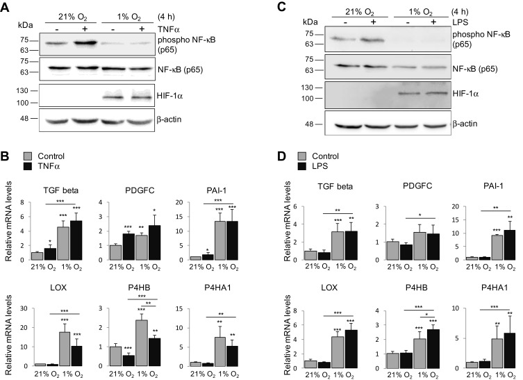 Hypoxia Induces Pro-Fibrotic and Fibrosis Marker Genes in Hepatocellular Carcinoma Cells Independently of Inflammatory Stimulation and the NF-κΒ Pathway.