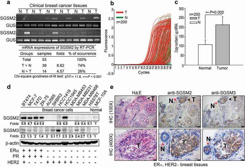 Small G protein signalling modulator 2 (SGSM2) is involved in oestrogen receptor-positive breast cancer metastasis through enhancement of migratory cell adhesion via interaction with E-cadherin.