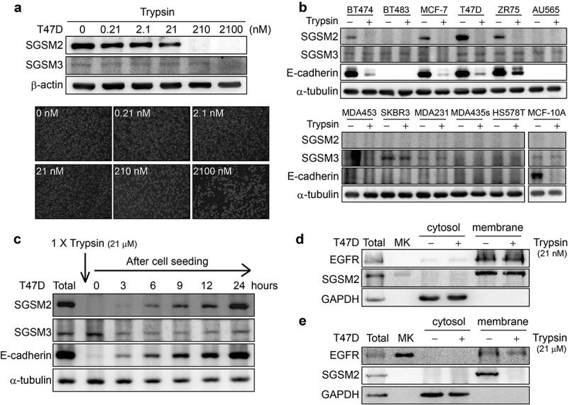 Small G protein signalling modulator 2 (SGSM2) is involved in oestrogen receptor-positive breast cancer metastasis through enhancement of migratory cell adhesion via interaction with E-cadherin.