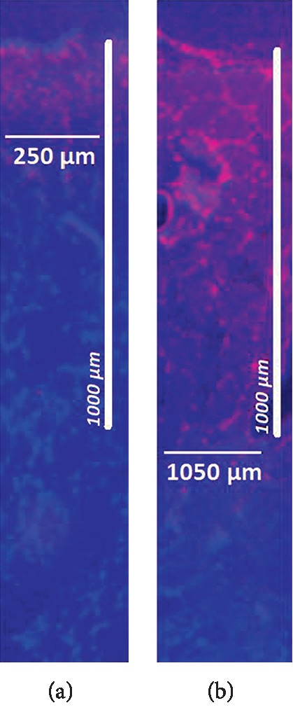 Increased Tissue Penetration of Doxorubicin in Pressurized Intraperitoneal Aerosol Chemotherapy (PIPAC) after High-Intensity Ultrasound (HIUS).