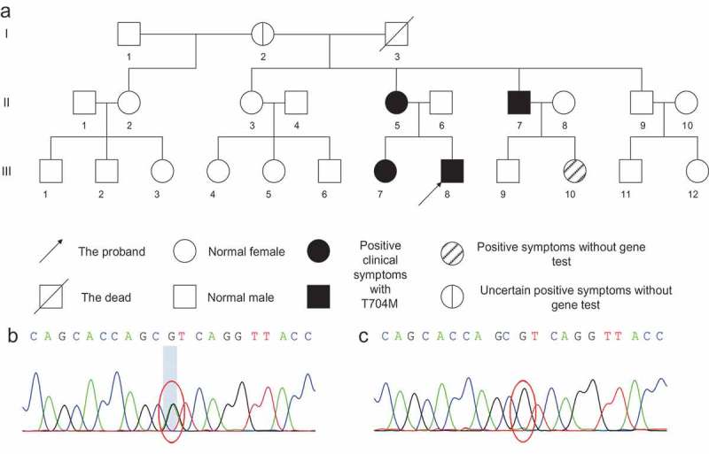 Overlap of periodic paralysis and paramyotonia congenita caused by SCN4A gene mutations two family reports and literature review.