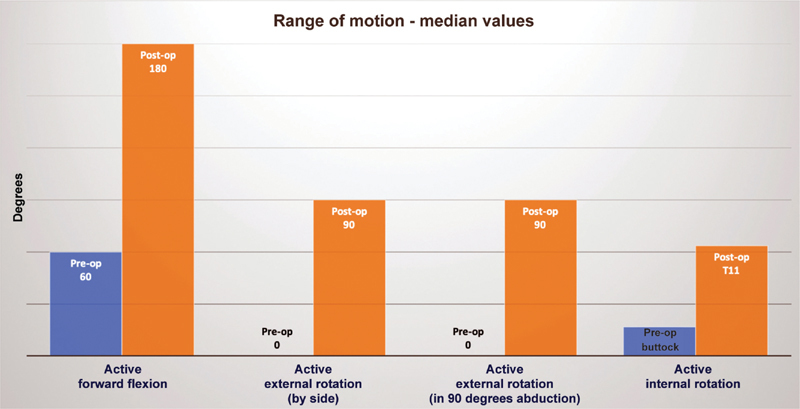 All-Arthroscopic McLaughlin's Procedure in Patients with Reverse Hill-Sachs Lesion Caused by Locked Posterior Shoulder Dislocation.