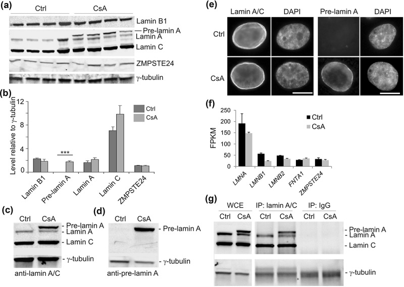 Interplay of lamin A and lamin B LADs on the radial positioning of chromatin.