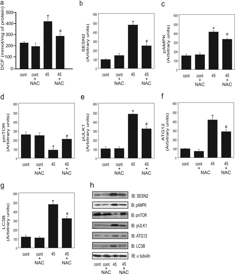 Cigarette smoke exposure induces ROS-mediated autophagy by regulating sestrin, AMPK, and mTOR level in mice.