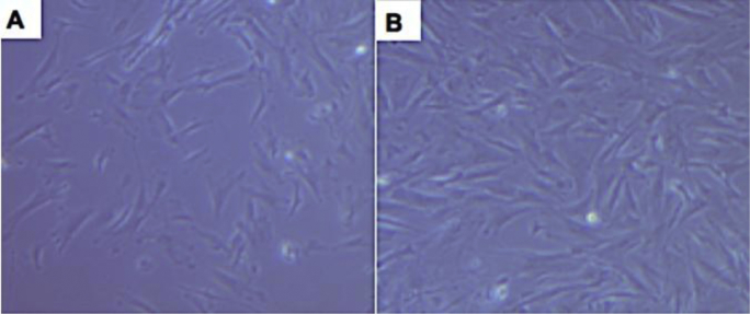 Bone marrow-derived mesenchymal stem cell (BM-MSC): A tool of cell therapy in hydatid experimentally infected rats