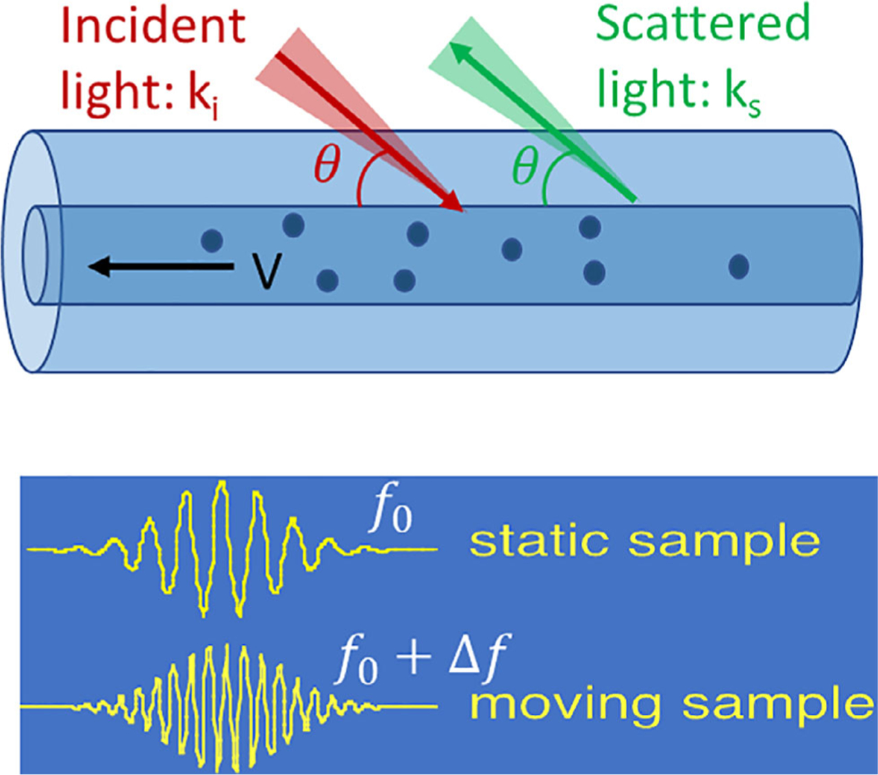 Advances in Doppler optical coherence tomography and angiography.