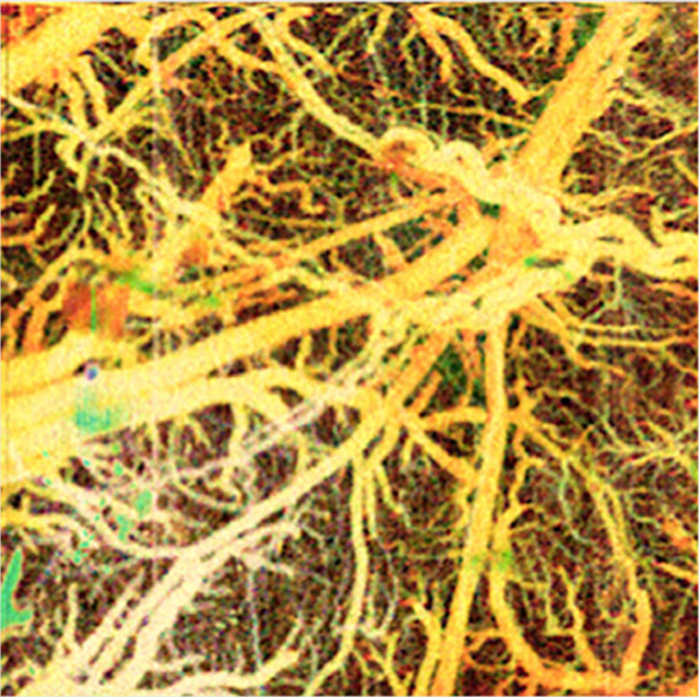 Advances in Doppler optical coherence tomography and angiography.