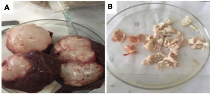 Bone marrow-derived mesenchymal stem cell (BM-MSC): A tool of cell therapy in hydatid experimentally infected rats