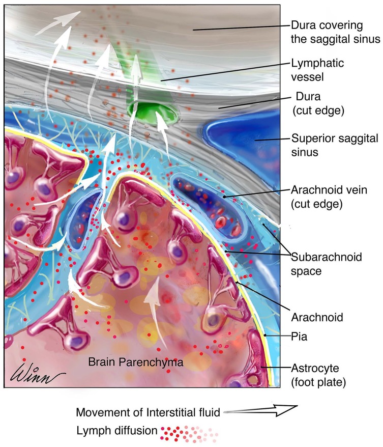 Meningeal Lymphatics: A Review and Future Directions From a Clinical Perspective.